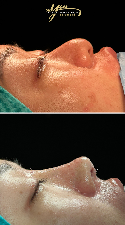 before-after