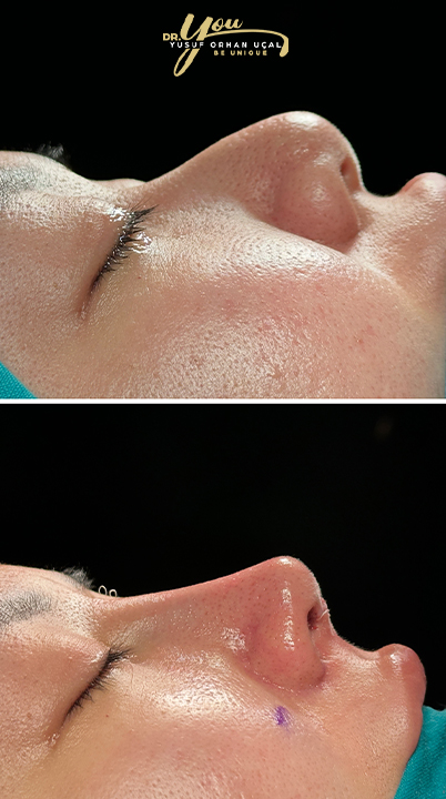 before-after