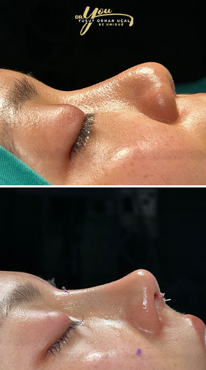 before-after