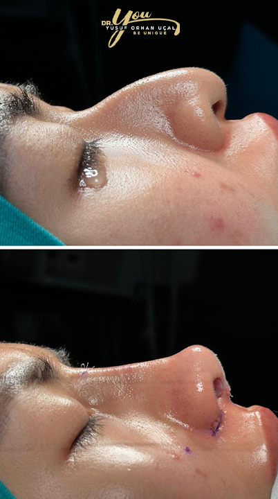 before-after