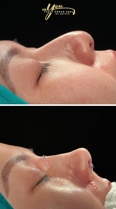 before-after