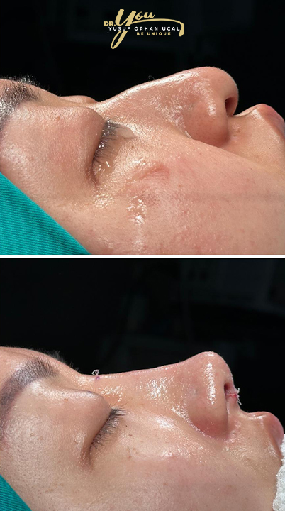 before-after