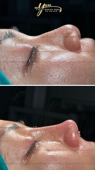 before-after